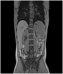MRI of the Abdomen3